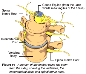 Sciatica