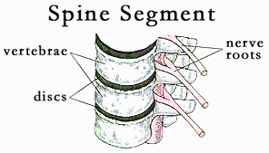 Sciatica